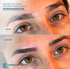 Microblading - Medcare Health & Beauty