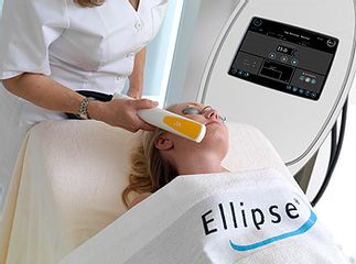 Ellipse Facial Hair Removal