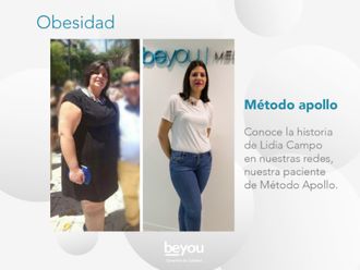 Tratamiento obesidad - 621088
