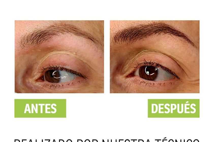 Micropigmentación antes y después - 739142