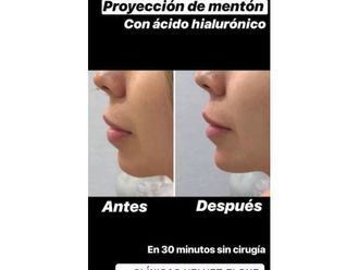 Cirugía maxilofacial - 643917