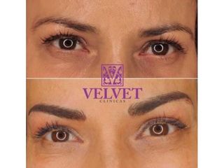 Antes y después Microblading - Clínicas Velvet