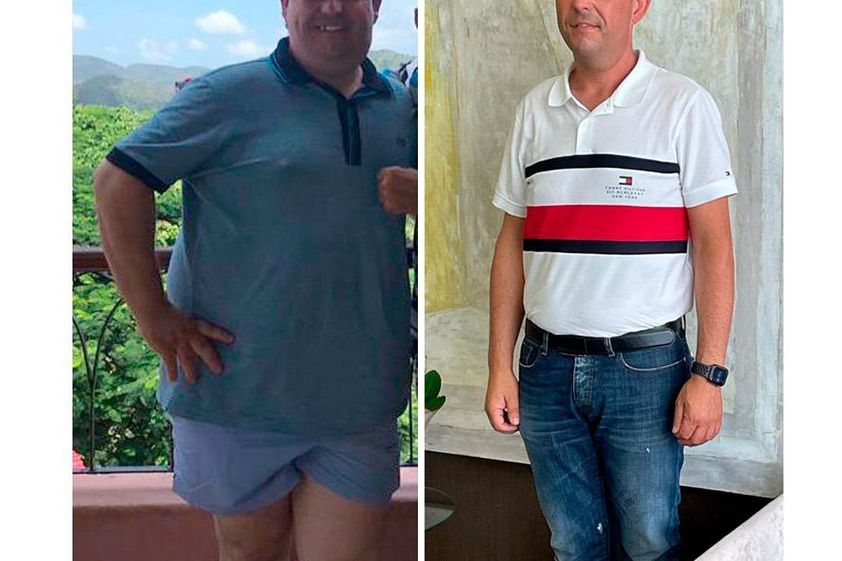 Manga gástrica antes y después - 813652