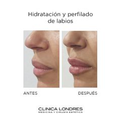 Hidratación y perfilado de labios