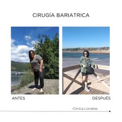 Cirugía bariátrica - Clínica Londres