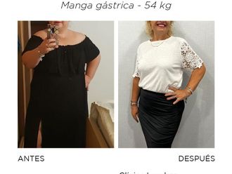 Manga gástrica antes y después - 868412