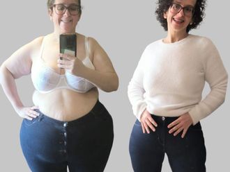 Tratamiento obesidad antes y después - 880085