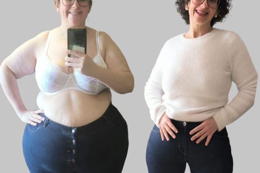 Tratamiento obesidad antes y después - 880085