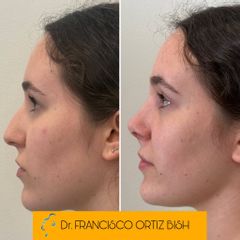 Dr Francisco Ortiz Bish - RSP Laura Perfil I AD