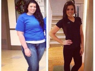 Antes y despues de perdida de peso