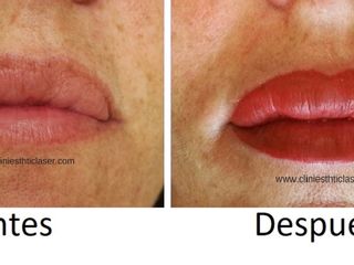 Antes y despues de micropígmentacion de labios