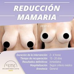 Reducción de senos - Centro CEME