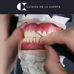 Prótesis dental -  clínica de la cuesta cdc