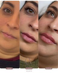 LABIOS - Amadea Clinic SL