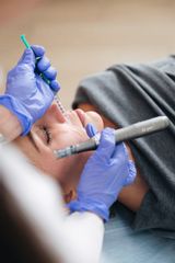 Mesoterapia facial con vitaminas