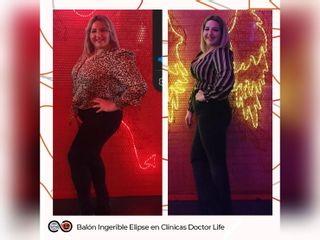 Clínicas Doctor Life - Balon Gastrico