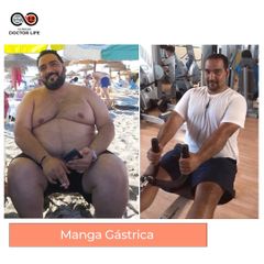 Manga gástrica - Clínicas Doctor Life
