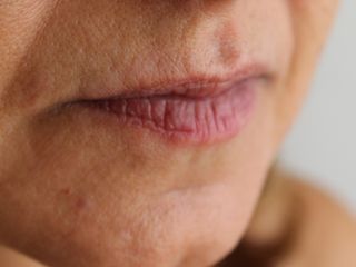 Micropigmentación labial antes del tratamiento.