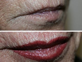 Antes y después Micropigmentación labios