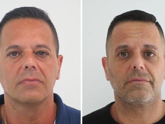 Blefaroplastia antes y después - 878559