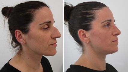 AyD limado caballte Dra. Uuya