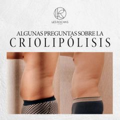 Criolipólisis - Les Rochas Clinic
