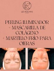 Peeling - Les Rochas Clinic