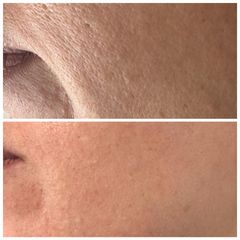 Exosomas de esperma de salmón