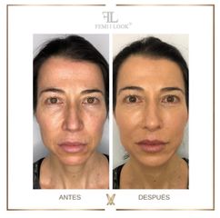 XV Clinic - FemiLook