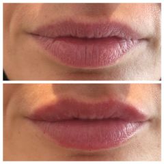 Hidratación y perfilado de labios