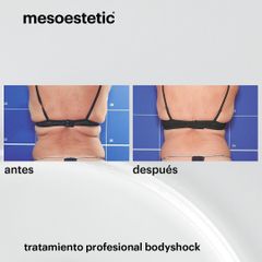 Tratamiento profesional bodyshock - Absolute Beauty