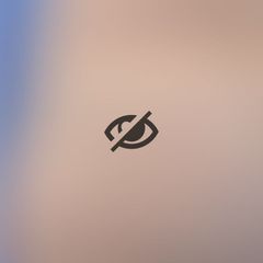 Antes y después Eliminación de ojeras - Dr. Joaquín Pérez Guisado Rosa