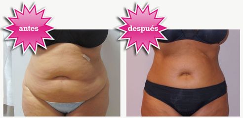 Antes y después corporal
