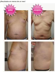 Resultado barriga