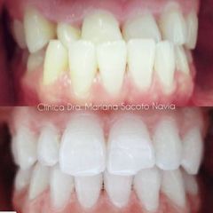 Ortodoncia - Clínica Dra. Mariana Sacoto Navia