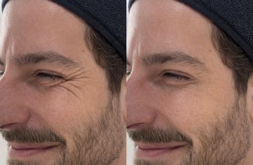 HR Clinic - Rejuvenecimiento facial