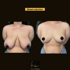 Before & afters Dr Karl Waked