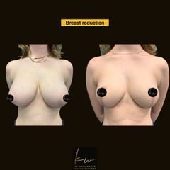 Before & afters Dr Karl Waked