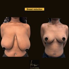 Before & afters Dr Karl Waked