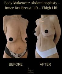 Dr. Karl Waked - Body Makeover