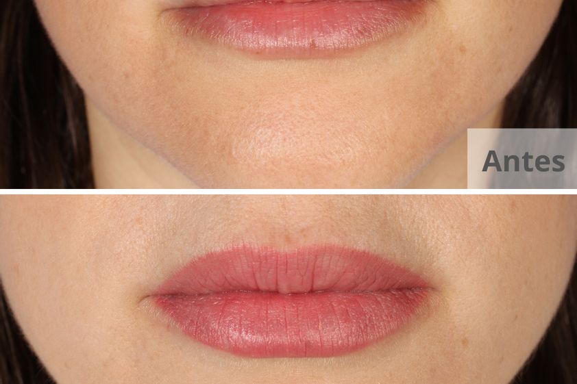 Micropigmentación antes y después - 801591