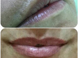Antes y después micropigmentación labios regenerados completamente
