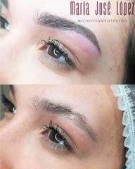 Antes y después Micropigmentación de Cejas con camuflaje de cicatriz