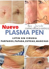 Plasma Pen - Centro Ana Jurado