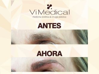 Microblading - 643576