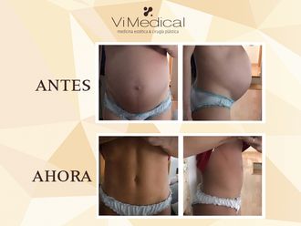 Dietas - 644047