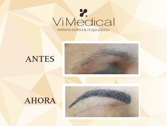 Micropigmentación - 645022