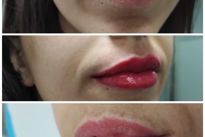 Micropigmentación antes y después - 829237