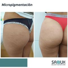 Micropigmentación - Clínica Sanux