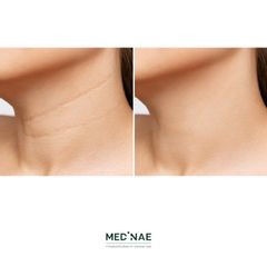 Medinae